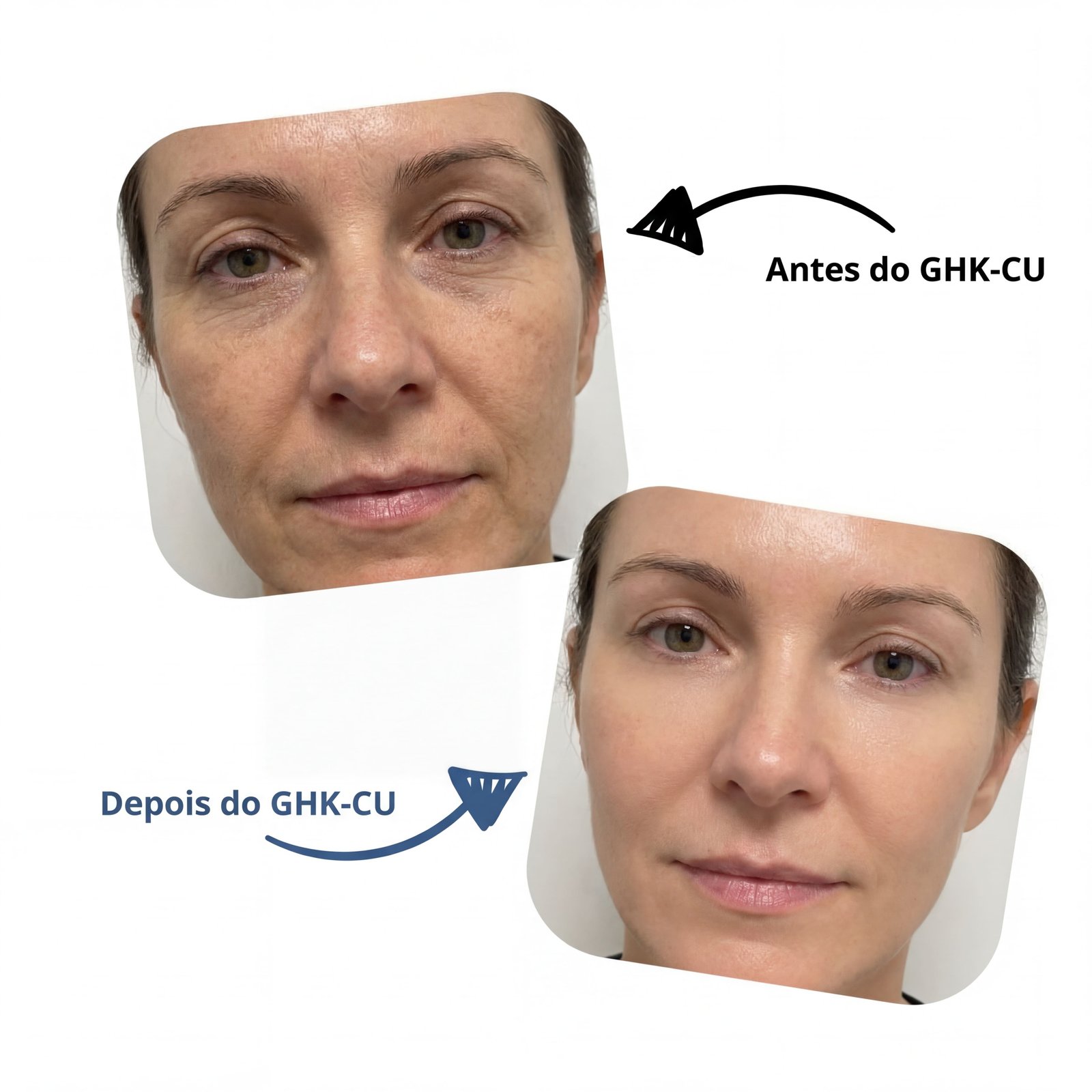 Antes e depois com GHK-Cu